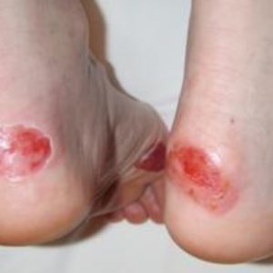 Outdoor 16 Hour First Aid Level 3 (VTQ)