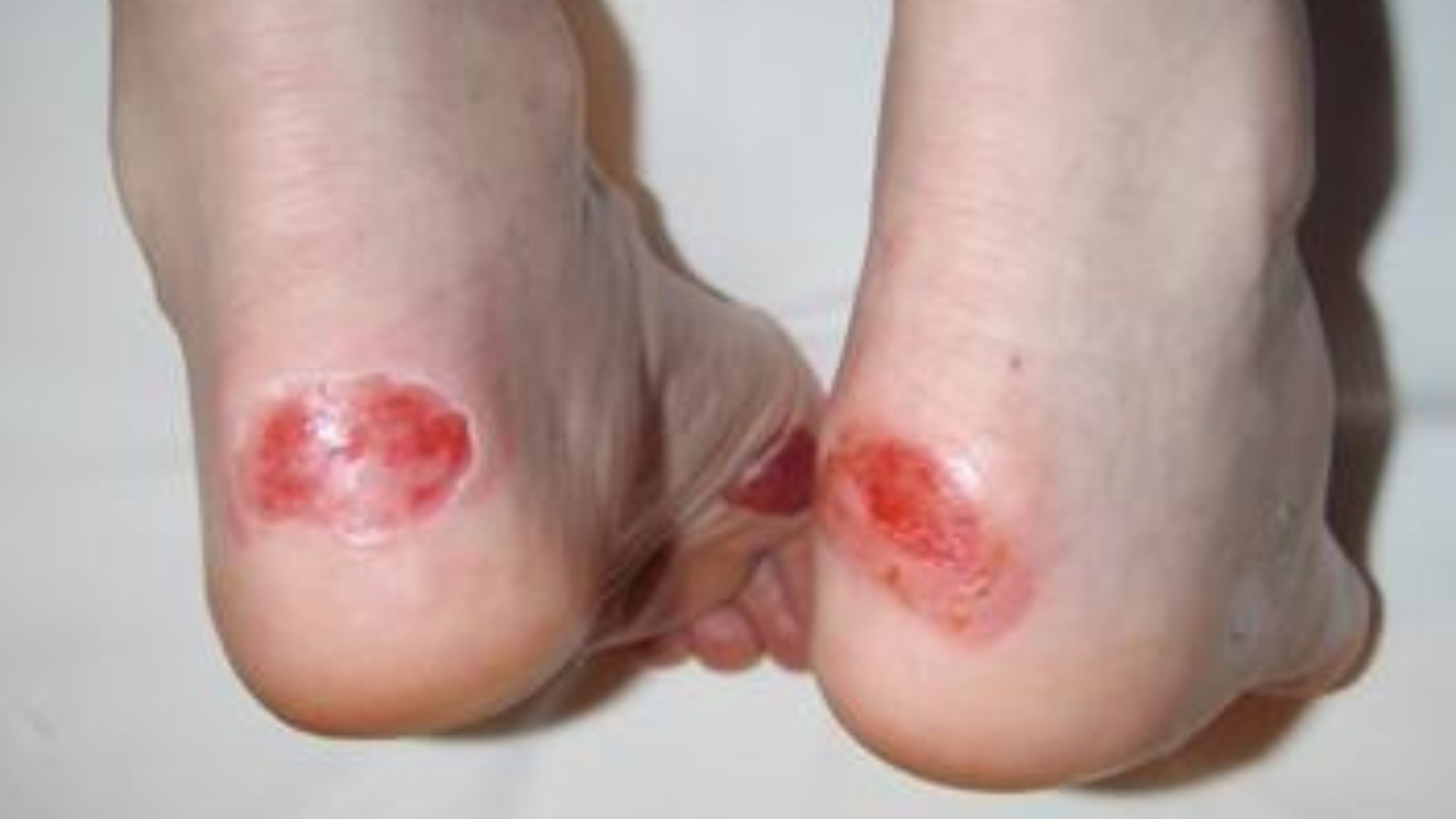 Outdoor 16 Hour First Aid Level 3 (VTQ) - Image 2